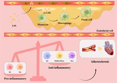 Macrophage polarization states in atherosclerosis